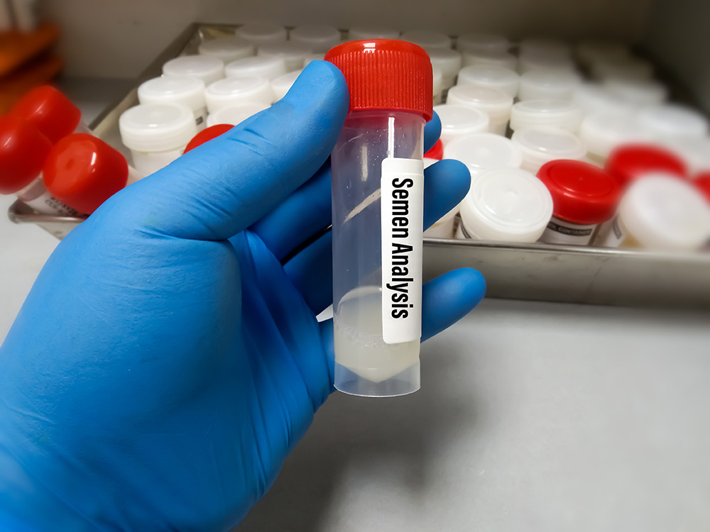 are vasectomies 100 effective, semen test after vasectomy, vasectomy contraception