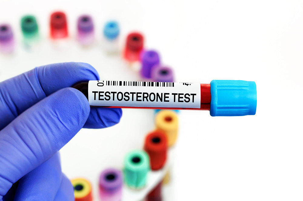 does a vasectomy affect testosterone levels, testosterone production in testicles, hormone function, vasectomy and hormones