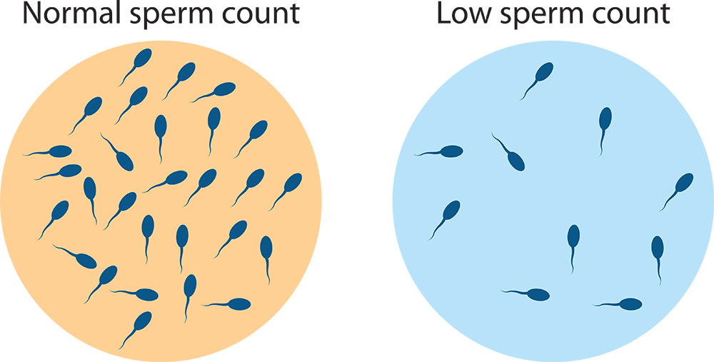 low sperm count signs, low sperm count, male fertility