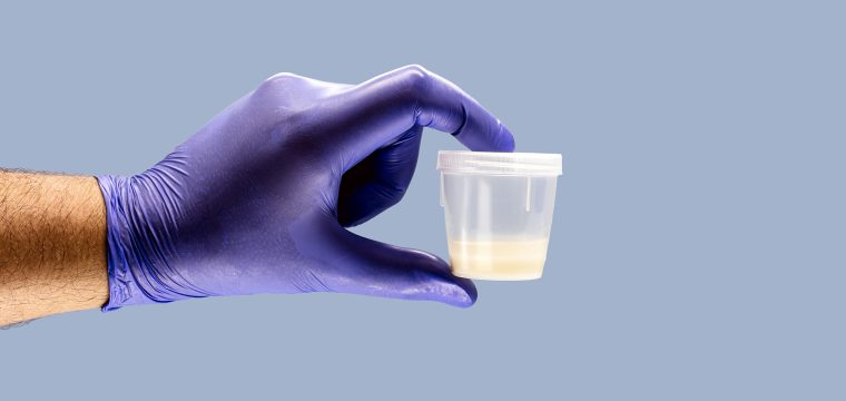 what colour should semen be normal semen colour what colour is healthy semen semen colour meaning