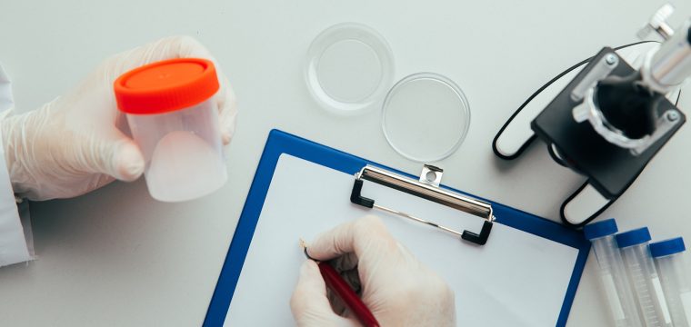 low sperm count signs, low sperm count, signs of low sperm count, low sperm count symptoms